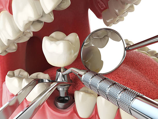 Best Weekend Emergency Dentist in St Helena, CA